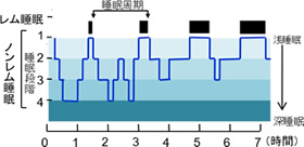 Q&A 質の良い睡眠とは?